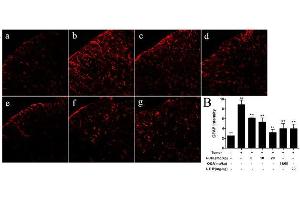 Immunohistochemistry (IHC) image for anti-Glial Fibrillary Acidic Protein (GFAP) (AA 51-150) antibody (ABIN726200)