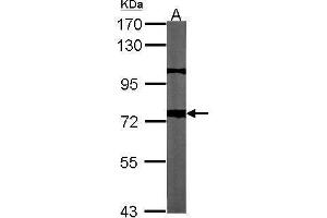 Western Blotting (WB) image for anti-Amyloid beta (A4) Precursor Protein (APP) (C-Term) antibody (ABIN2855011)