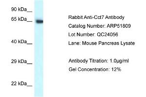 Western Blotting (WB) image for anti-Chaperonin Containing TCP1, Subunit 7 (Eta) (CCT7) (C-Term) antibody (ABIN970320) (CCT7 抗体  (C-Term))