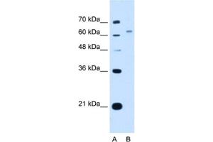 Western Blotting (WB) image for anti-WSC Domain Containing 2 (WSCD2) antibody (ABIN2463039) (WSCD2 抗体)