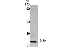 Western Blot analysis of extracts from rat stomach, using M6A Polyclonal Antibody. (METTL3 抗体  (AA 140-220))