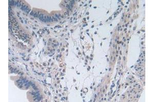 IHC-P analysis of Mouse Uterus Tissue, with DAB staining. (IL-2 抗体  (AA 10-169))