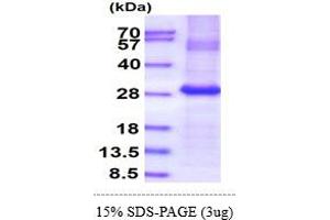 SDS-PAGE (SDS) image for Folate Receptor 1 (Adult) (FOLR1) (AA 25-234) protein (His tag) (ABIN5854043) (FOLR1 Protein (AA 25-234) (His tag))