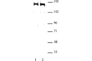 DNMT1 antibody (pAb) tested by Western blot. (DNMT1 抗体  (AA 1-110))