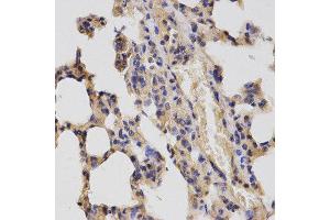 Immunohistochemistry (IHC) image for anti-Cullin 2 (CUL2) antibody (ABIN1876496) (Cullin 2 抗体)