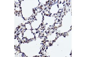 Immunohistochemistry of paraffin-embedded rat lung using R Rabbit mAb (ABIN7269844) at dilution of 1:100 (40x lens). (RanBP3 抗体)