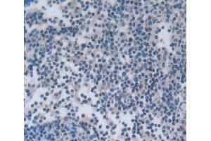 Used in DAB staining on fromalin fixed paraffin- embedded lymph node tissue (NCR1 抗体  (AA 17-211))