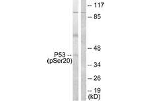 Western blot analysis of extracts from COS7 cells treated with UV 5', using p53 (Phospho-Ser20) Antibody. (p53 抗体  (pSer20))