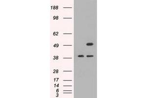 HEK293T cells were transfected with the pCMV6-ENTRY control (Left lane) or pCMV6-ENTRY CD4 (Right lane) cDNA for 48 hrs and lysed. (CD4 抗体)