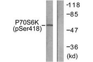 Western blot analysis of extracts from HT29 cells treated with serum 20% 15', using p70 S6 Kinase (Phospho-Ser418) Antibody. (RPS6KB1 抗体  (pSer418))