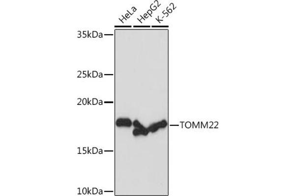 TOMM22 抗体