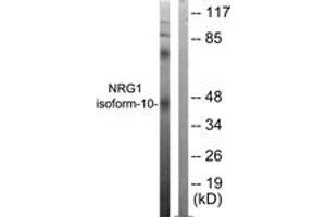 Western blot analysis of extracts from SKOV3 cells, using NRG1 isoform-10 Antibody. (NRG1 Isoform-10 (AA 1-50) 抗体)
