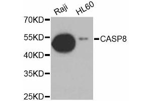 Western blot analysis of extracts of various cell lines, using CASP8 antibody. (Caspase 8 抗体)