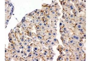 IHC testing of FFPE mouse liver with OPA1 antibody. (OPA1 抗体)