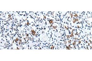 Immunohistochemistry of paraffin-embedded Human tonsil tissue using HCRT Polyclonal Antibody at dilution of 1:25(x200) (Orexin 抗体)