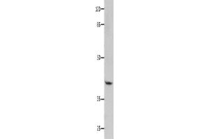 Western Blotting (WB) image for anti-Guanine Nucleotide Binding Protein (G Protein), alpha 11 (Gq Class) (GNA11) antibody (ABIN2428140) (GNA11 抗体)