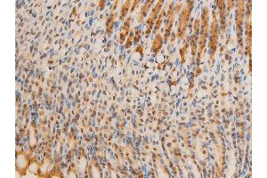 Immunohistochemistry (IHC) image for anti-Nuclear Factor-kB p65 (NFkBP65) (pSer536) antibody (ABIN6255402)