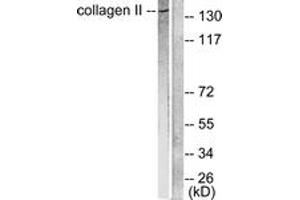 Western blot analysis of extracts from COLO205 cells, using Collagen II Antibody. (COL2 抗体  (AA 101-150))