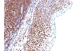 Formalin-fixed, paraffin-embedded human Tonsil stained with SUMO-1 Monoclonal Antibody (SUMO1/1188) (SUMO1 抗体)