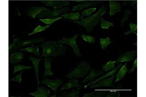 Immunofluorescence of monoclonal antibody to PML on HeLa cell. (PML 抗体  (AA 411-510))