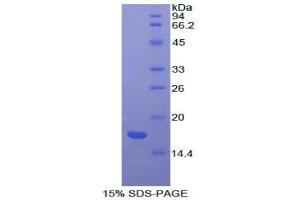 SDS-PAGE analysis of Cow ACVR2A Protein. (ACVR2A 蛋白)