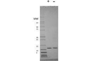 SDS-PAGE of Human Interferon-alpha 2a Recombinant Protein SDS-PAGE of Human Interferon-alpha 2a Recombinant Protein. (IFNA2 蛋白)