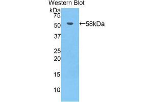 Western Blotting (WB) image for anti-Bruton Agammaglobulinemia tyrosine Kinase (BTK) (AA 396-659) antibody (ABIN1858180) (BTK 抗体  (AA 396-659))