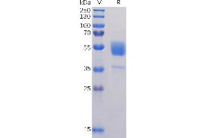 Human CD37 Protein, hFc Tag on SDS-PAGE under reducing condition. (CD37 Protein (AA 112-241) (Fc Tag))