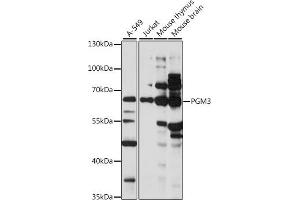 Western blot analysis of extracts of various cell lines, using PGM3 antibody (ABIN7269314) at 1:1000 dilution. (Phosphoglucomutase 3 抗体  (AA 1-300))