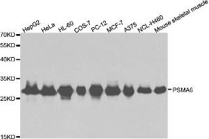 Western blot analysis of extracts of various cell lines, using PSMA6 antibody. (PSMA6 抗体)
