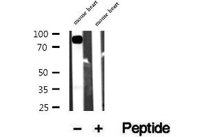 Western blot analysis of extracts of mouse heart tissue, using Aconitase 2 antibody. (ACO2 抗体  (Internal Region))