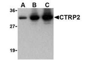 Image no. 1 for anti-C1q and Tumor Necrosis Factor Related Protein 2 (C1QTNF2) antibody (ABIN207843) (C1QTNF2 抗体)