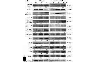 Western Blotting (WB) image for anti-Caspase 3 (CASP3) (AA 60-100) antibody (ABIN724625)