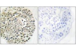 Immunohistochemistry (IHC) image for anti-Tripartite Motif Containing 16 (TRIM16) (AA 31-80) antibody (ABIN2889360) (TRIM16 抗体  (AA 31-80))