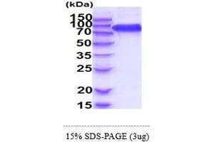 SDS-PAGE (SDS) image for Fibroblast Growth Factor Receptor 3 (FGFR3) (AA 23-375) protein (hIgG-His-tag) (ABIN5854978) (FGFR3 Protein (AA 23-375) (hIgG-His-tag))