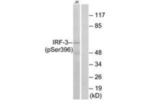 Western blot analysis of extracts from Jurkat cells treated with EGF 200ng/ml 30', using IRF-3 (Phospho-Ser396) Antibody. (IRF3 抗体  (pSer396))