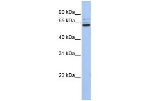 GEFT antibody used at 1 ug/ml to detect target protein. (ARHGEF25/GEFT 抗体  (C-Term))