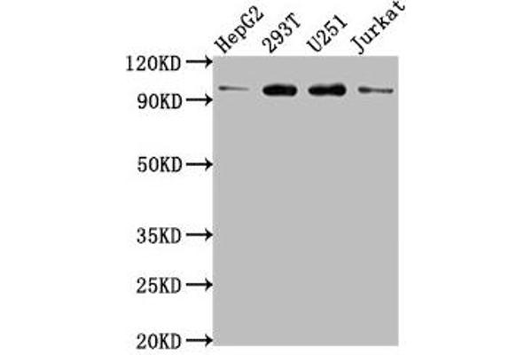 KPNB1 抗体  (AA 9-214)
