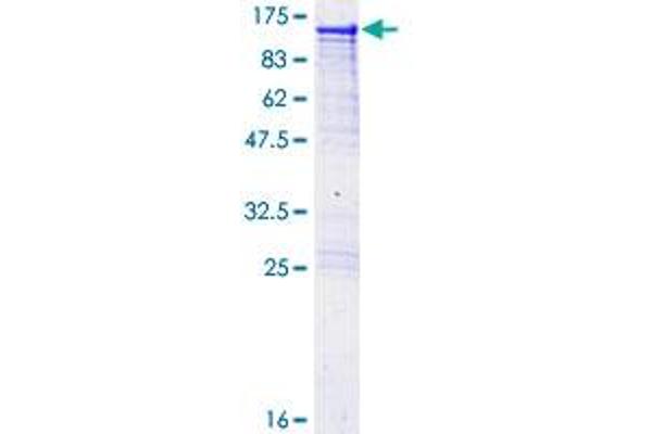 AARS Protein (AA 1-968) (GST tag)