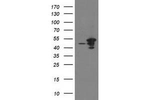 Western Blotting (WB) image for anti-ADP-Ribosylation Factor GTPase Activating Protein 1 (ARFGAP1) antibody (ABIN1496684) (ARFGAP1 抗体)