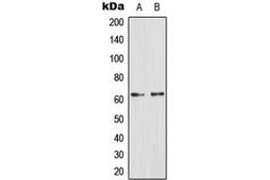 Western blot analysis of Glucagon Receptor expression in PC12 (A), Jurkat (B) whole cell lysates. (Glucagon Receptor 抗体  (Center))