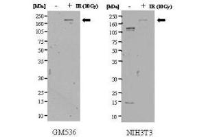 Anti-SMC1 pS957 Antibody - Western Blot. (SMC1B 抗体  (pSer957))