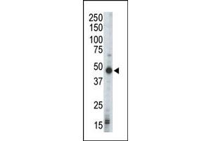 Image no. 1 for anti-Protein Kinase, CAMP-Dependent, Regulatory, Type I, beta (PRKAR1B) (N-Term) antibody (ABIN359120) (PRKAR1B 抗体  (N-Term))