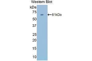 Western Blotting (WB) image for anti-Catalase (CAT) (AA 10-507) antibody (ABIN1858264) (Catalase 抗体  (AA 10-507))