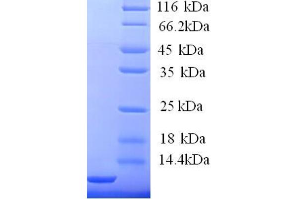 FCER1G Protein (AA 45-86, Cytoplasmic Domain, Cytosolic) (His tag)