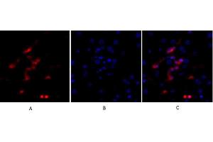 Immunofluorescence analysis of human liver tissue. (p53 抗体)