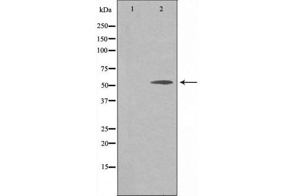 Apoptosis Inhibitor 5 抗体  (C-Term)