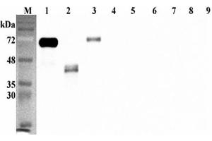 Western blot analysis using anti-DLK1 (human), pAb  at 1:5'000 dilution. (DLK1 抗体  (Extracellular Domain))