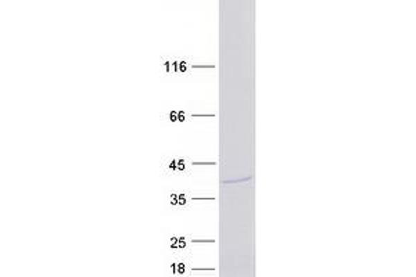 ATP6V1E1 Protein (Transcript Variant 1) (Myc-DYKDDDDK Tag)