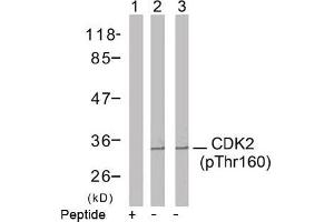 Image no. 2 for anti-Cyclin-Dependent Kinase 2 (CDK2) (pThr160) antibody (ABIN196845) (CDK2 抗体  (pThr160))